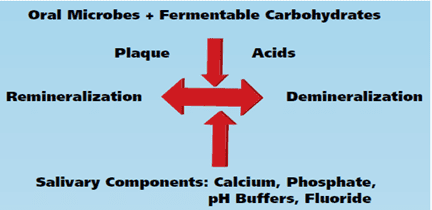 penyebab karies gigi