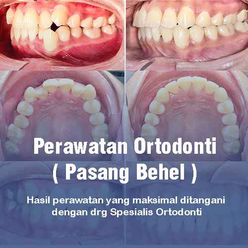 KLINIK GIGI KELAPA GADING