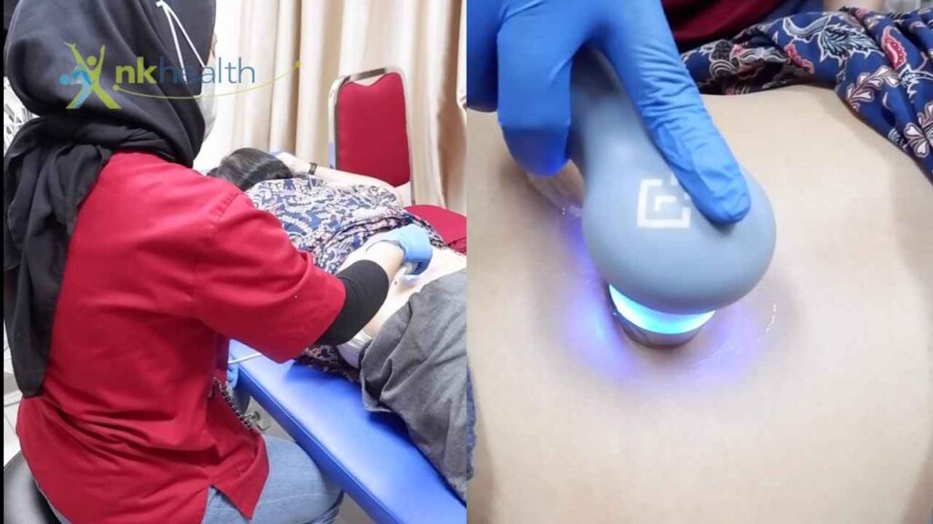 Mengatasi Saraf Kejepit pinggang