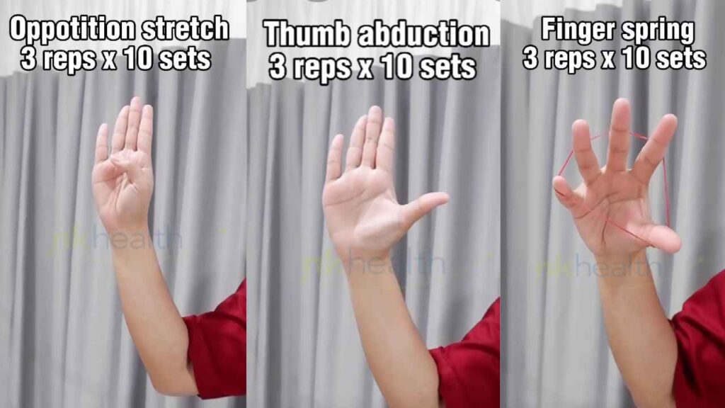 Latihan Menyembuhkan De Quervain Syndrome