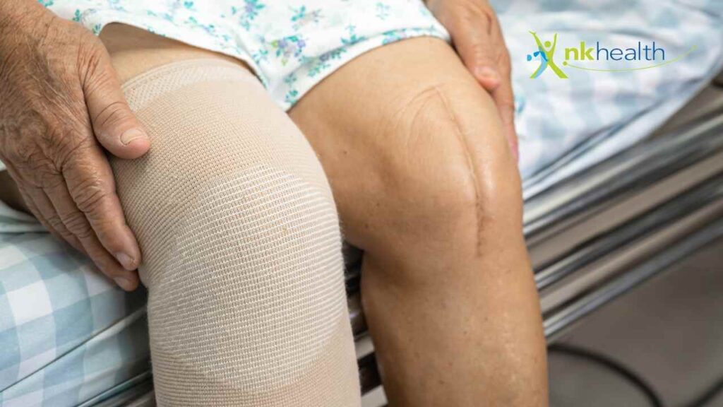 Fisioterapi Pasca Operasi Lutut