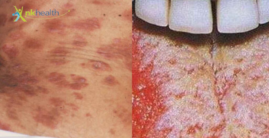 Penyebab HIV dan AIDS