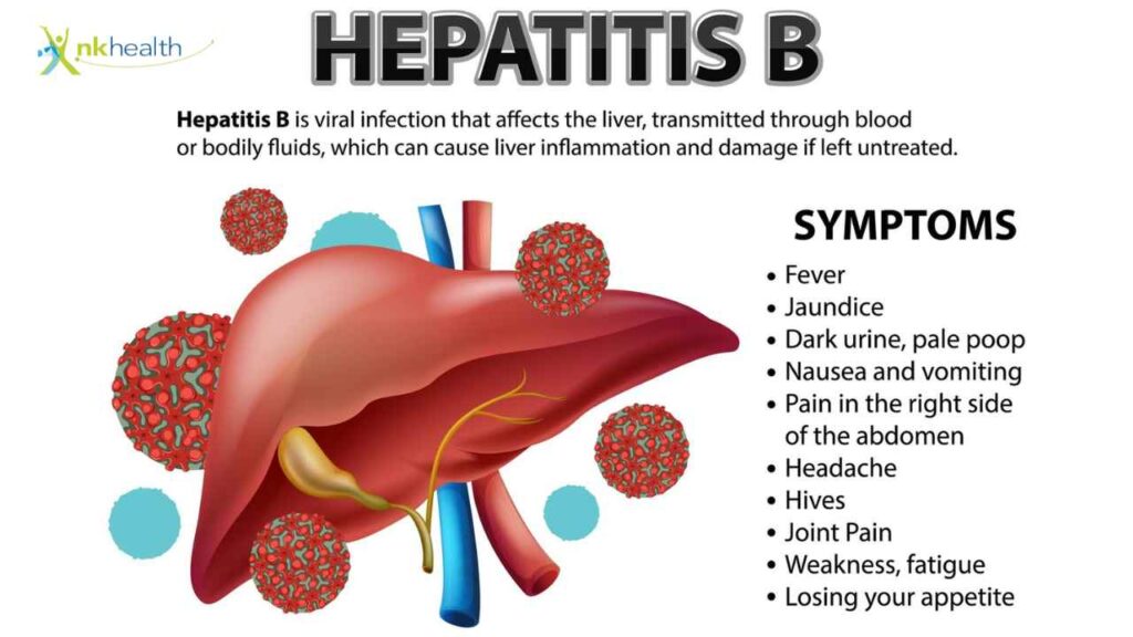 Gejala Hepatitis B