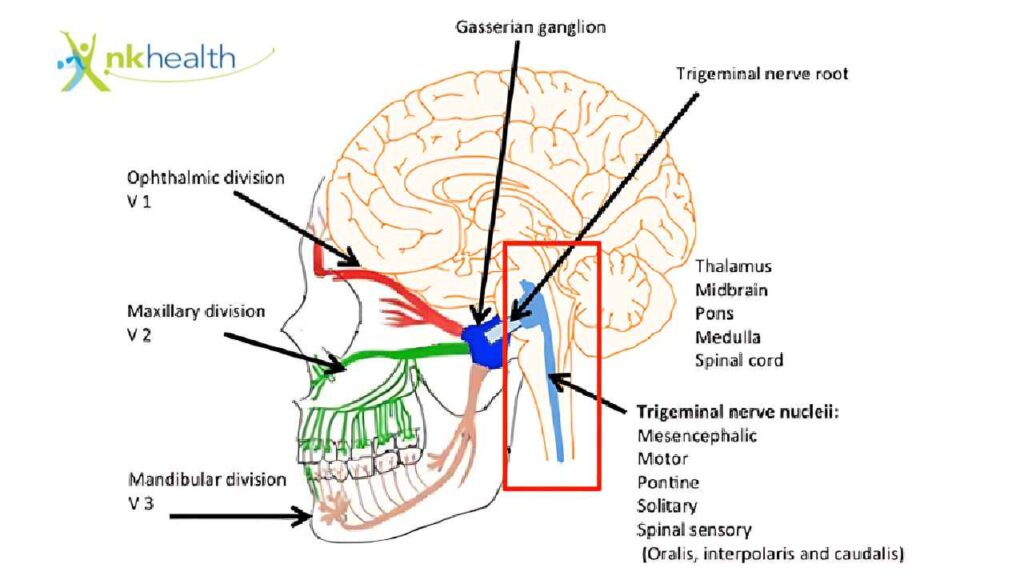trigeminal nerve root