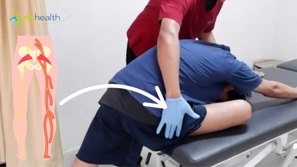 nyeri saraf sciatica