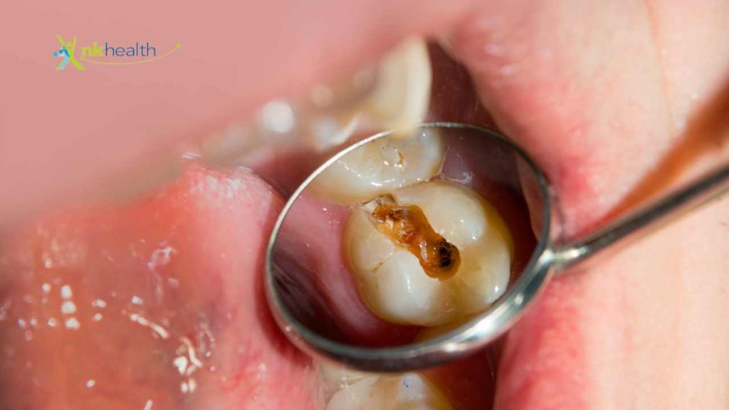 Bahaya Tambal Gigi di Tukang Gigi