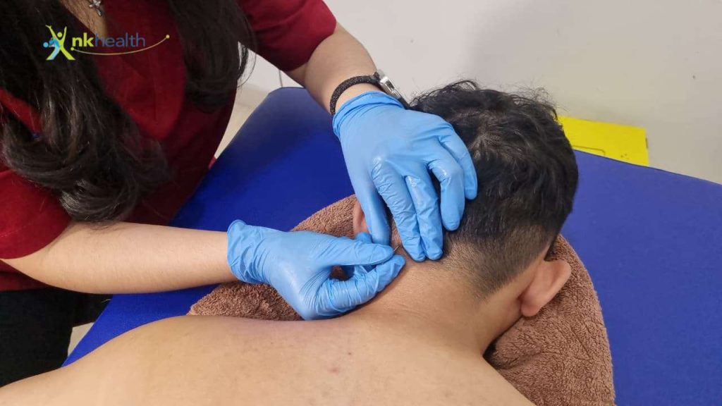 Cara Mengobati Tension Headache