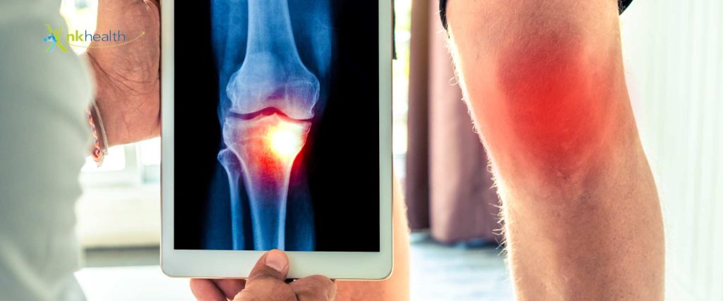 Macam-Macam Cedera Lutut