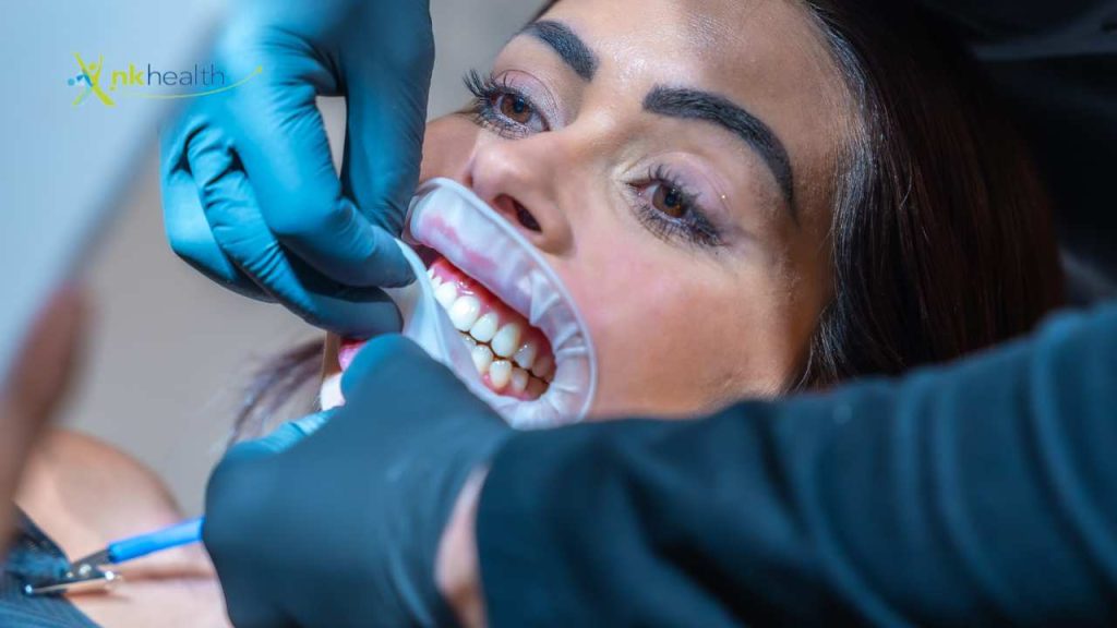 Bleaching Gigi Terdekat di Jakarta