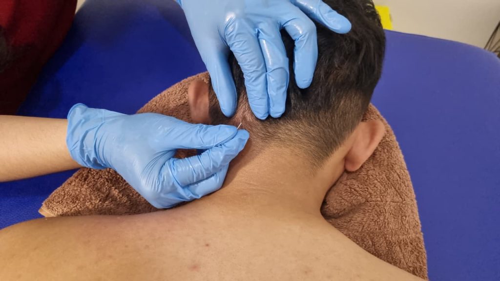 Tension Headache Treatment dengan Fisioterapi