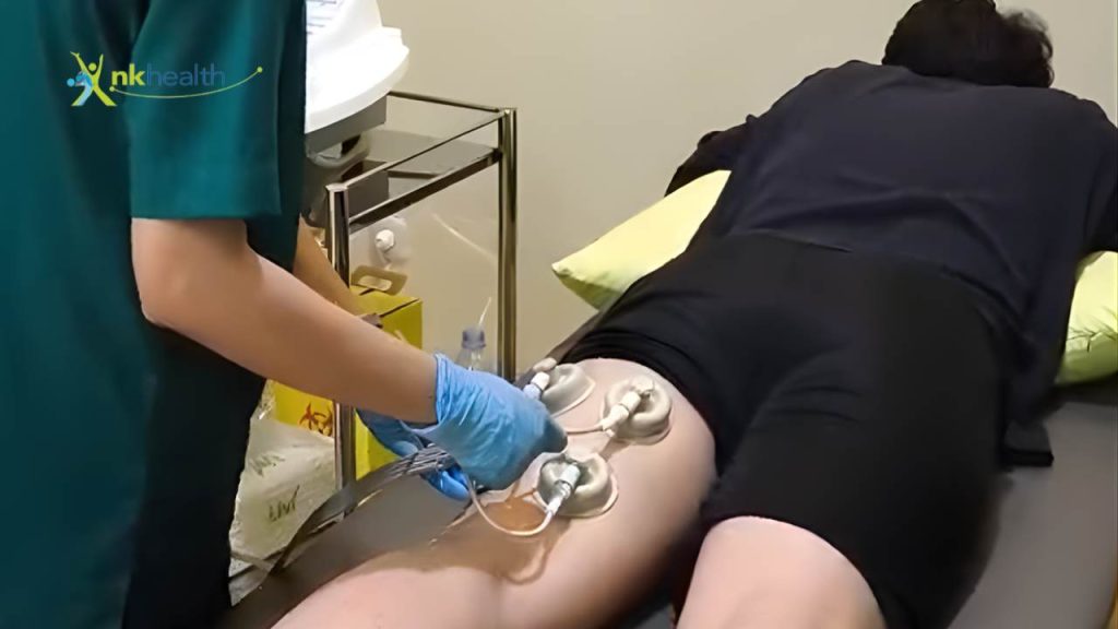 Berapa Lama Cedera Hamstring Sembuh