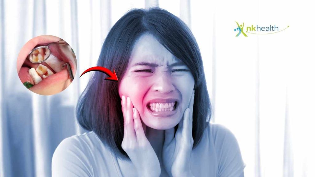 Cara Mengobati Sakit Gigi Berlubang