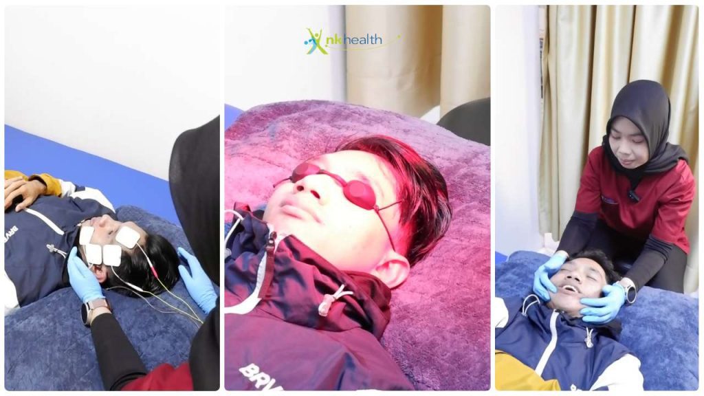 Fisioterapi Bell's Palsy Terbaik