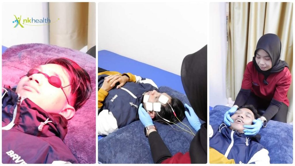 Perawatan Bell's Palsy