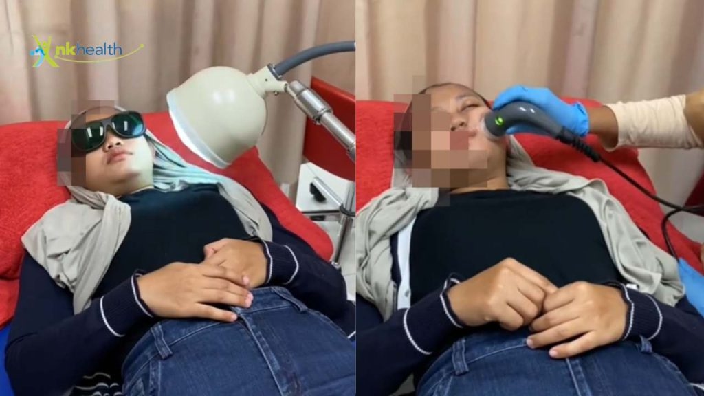 fisioterapi bell's palsy