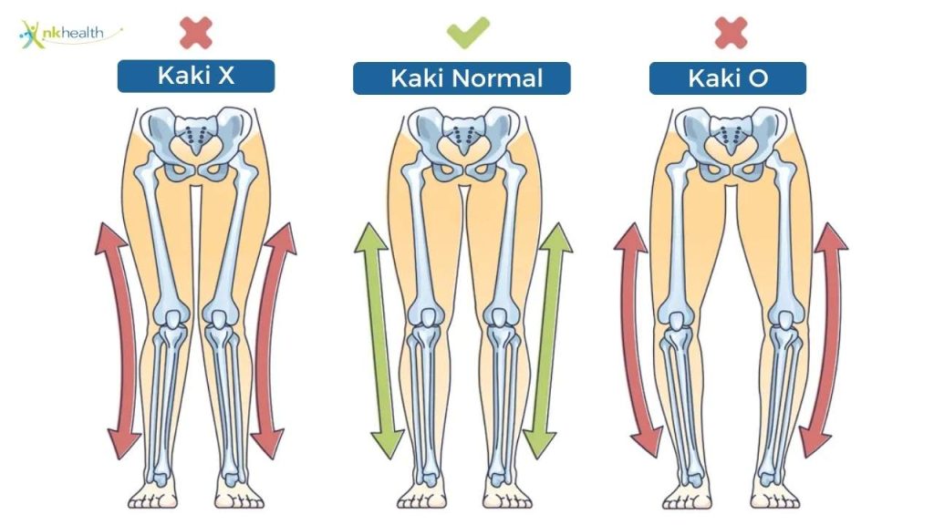 Perbedaan Kaki O dan Kaki X