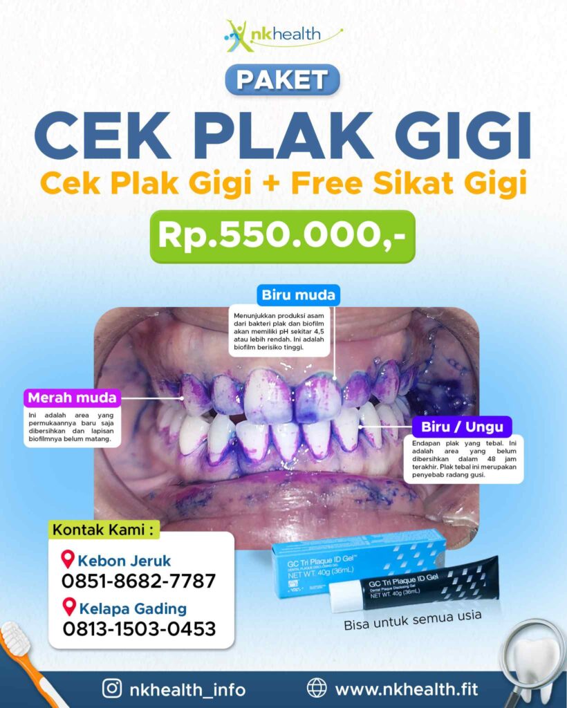 Cara Menghilangkan Plak Gigi