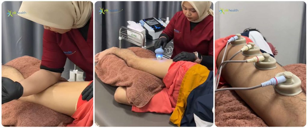 Penanganan Fisioterapi ITB Syndrome