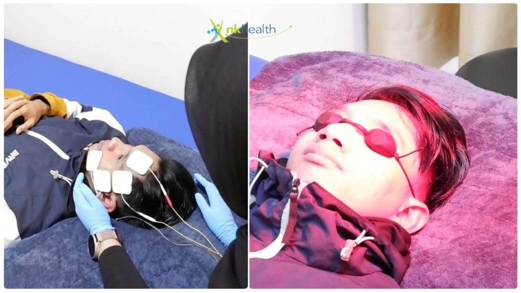 Pengobatan Bell's Palsy Jakarta