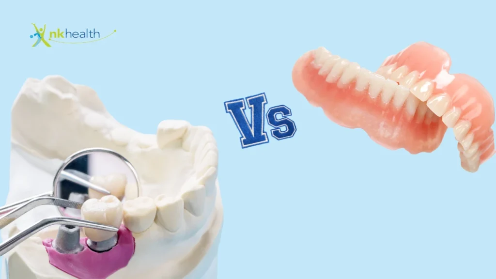 Lebih Baik Gigi Palsu Permanen atau Lepasan?