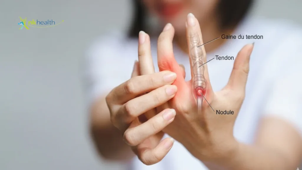 Penyebab Jari Tangan Kaku Saat Bangun Tidur