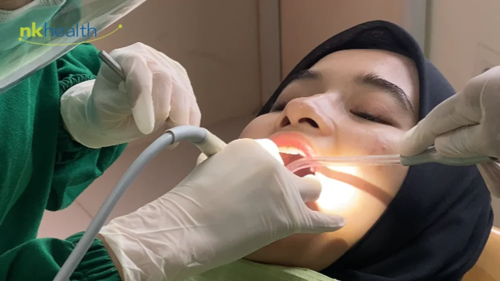 scaling gigi Berapa Bulan Sekali?