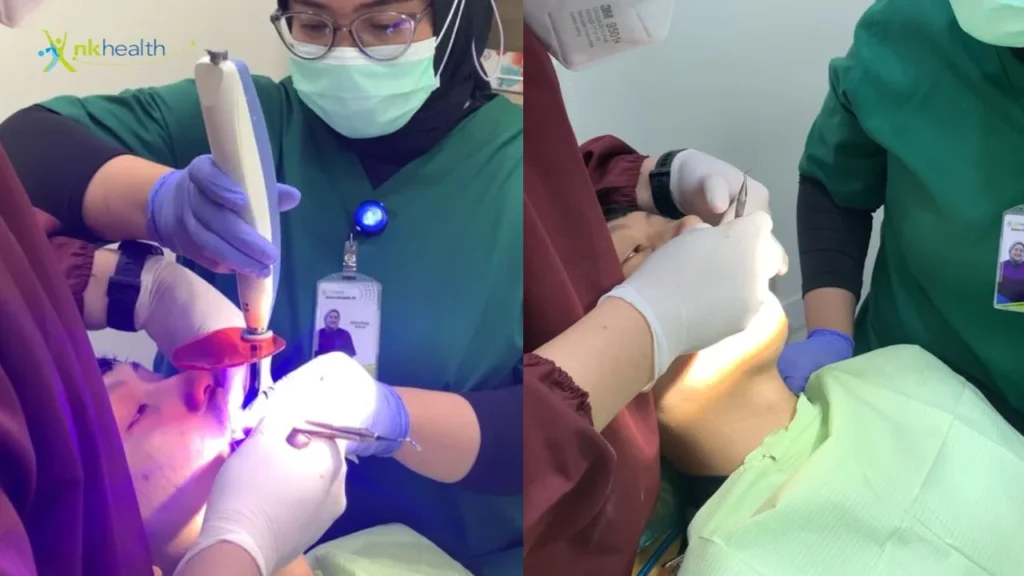 Berapa Lama Tambalan Gigi Bertahan?