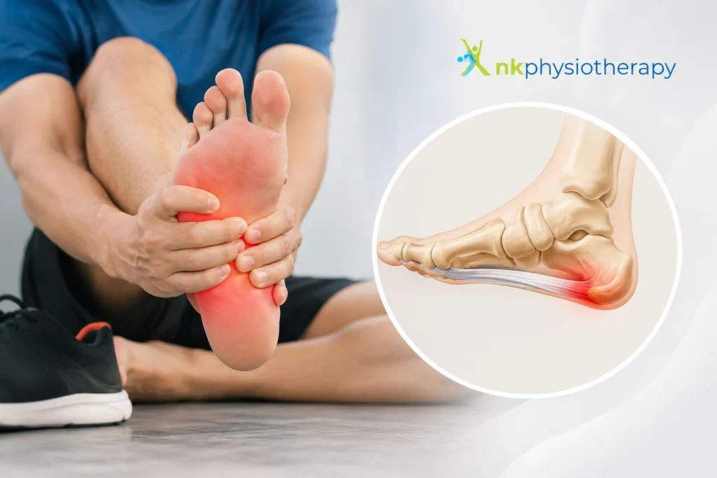 terkena plantar fasciitis